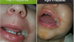 Bebeğinin Ağzı Bir Şarj Cihazının Ucundan Yanınca Herkesi Uyaran Anne