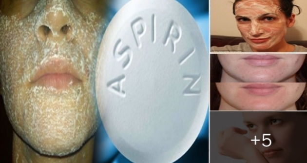 Aspirinin Ciltteki Mucizevi Etkisi