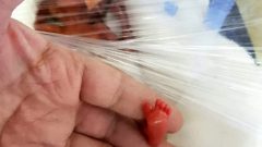 Birkaç saat içinde ölür dediler ama onlar umudunu hiç kaybetmedi