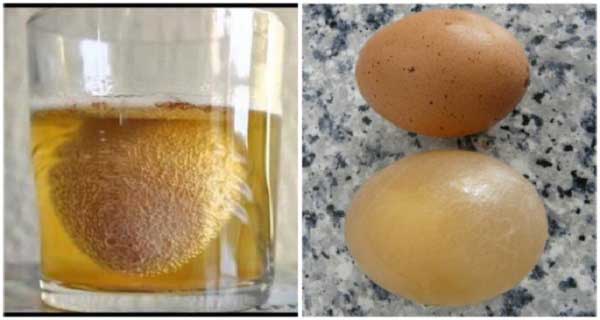 Eklem Ağrılarına Son Veren Elma Sirkesi Yumurta Kabuğu Tedavisi