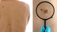 Hepsi birbirinden etkili Et benlerini düşüren yöntemler