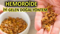 Ameliyatsız Hemoroitten Kurtulma Yöntemleri