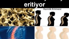 Bu İçecek Kemiklerinizi İçten İçe Eritiyor Ama Hala İçmeye Devam Ediyorsunuz!