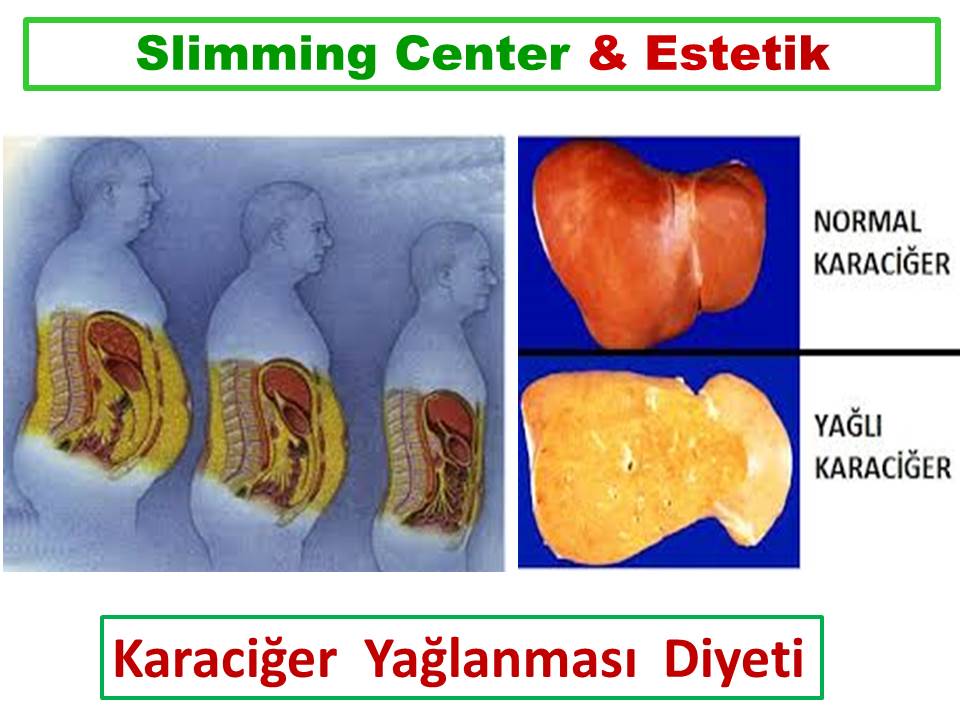 Karaciğer Yağlanmasını En Aza İndiren ve Kilo Verdiren 3 Günlük Kür