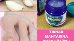 Tırnak Mantarına Kesin Çözüm Hemen Deneyip Kurtulun