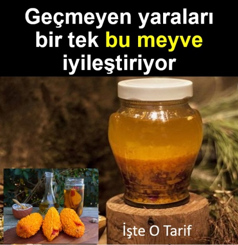 Geçmeyen Yaraları Bir Tek Bu Meyve Geçirir..