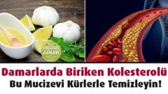 Damarlarda Biriken Kolesterolü Temizleyin