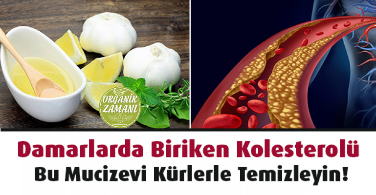 Damarlarda Biriken Kolesterolü Temizleyin