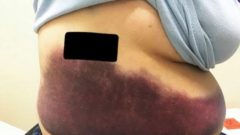 İnanmayacaksınız ama onu bu hale öksürük getirdi