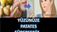 Yüzünüze Patates Sürerseniz 1 Gecede Bakın Neler Değişecek ?