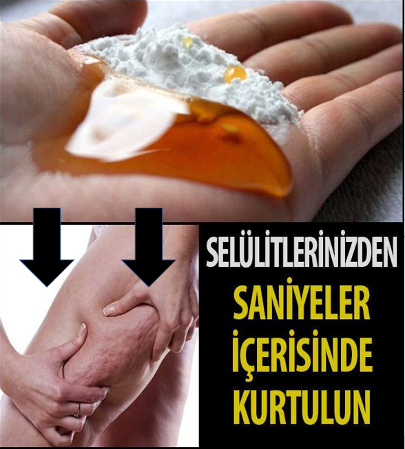 Selülitlerinizden Saniyeler İçerisinde Kurtulun