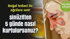 Sinüzitten 5 Günde Nasıl Kurtulursunuz