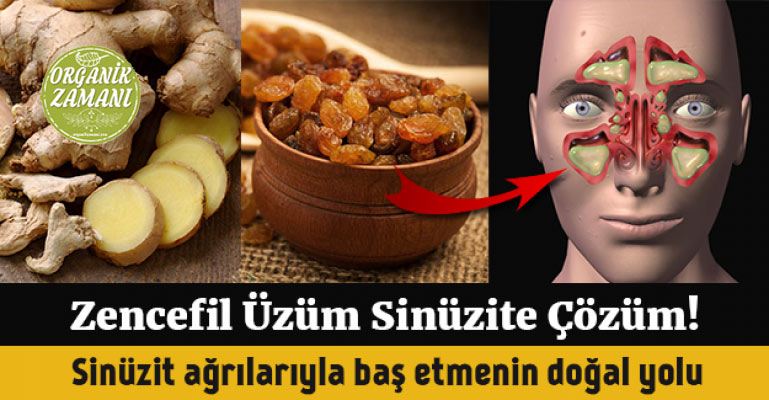 Zencefil, Üzüm Sinüzite Kesin Çözüm