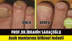 İbrahim Saraçoğlu’ndan Tırnak Mantarı İçin Bitkisel Tedavi