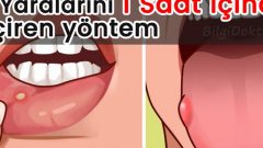 Aft ve Ağız Yarasına Karşı Mucize Buluş