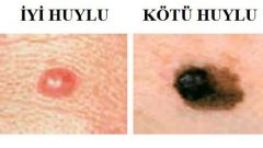 Benler Hakkında Bilmeniz Gereken Her Şey