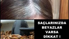 Saçlarınızda Beyazlar Varsa Ceviz Kabuğuyla Hergün
