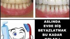 Aslında Evde Dişleri Beyazlatmak Bu Kadar Kolay İşte Yöntem