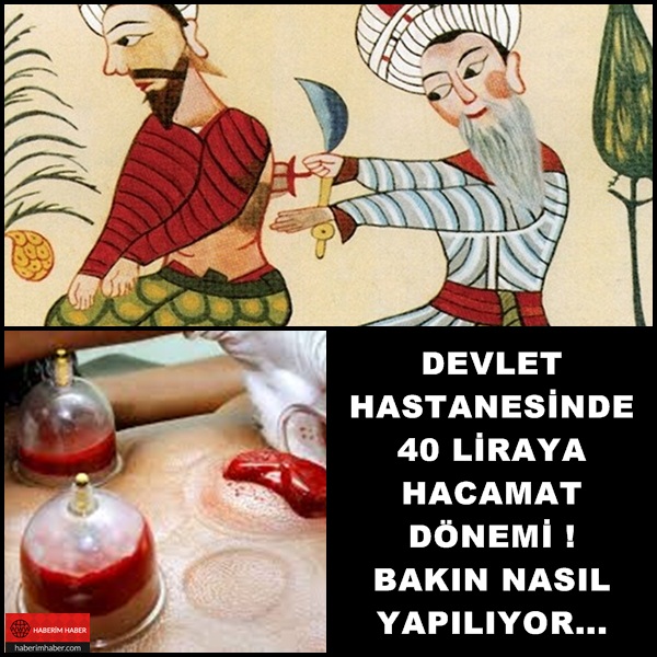 Devlet Hastanesinde 40 Liraya Hacamat Dönemi Başlayacakmış