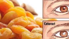 Katarakt Hastalığından Kurtulmanın En Basit Yolu