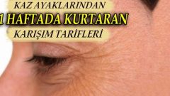 Bu Doğal Yöntemle 1 Hafta İçinde Kaz Ayaklarından Kurtulabilirsiniz