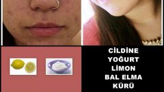 Cildine Yoğurt Limon Bal Ve Elma Kürü Uyguladıktan Sonra ki Değişiklik