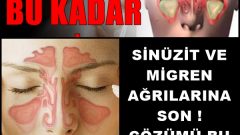 Sinüzit Ve Migren Ağrılarına Son Çözümü Bu Kadar Kolaymış