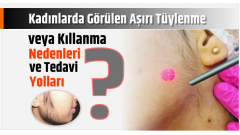Kadınlarda Görülen Aşırı Tüylenme