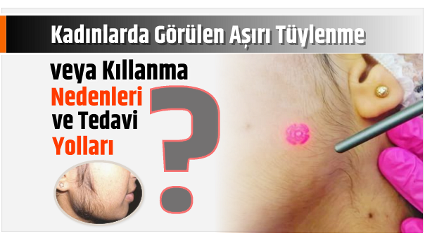 Kadınlarda Görülen Aşırı Tüylenme