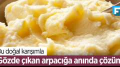 Gözde çıkan arpacığı anında geçiriyor