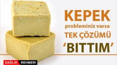 Kepek Ve Saç Dökülme Probleminiz Varsa Tek Çözümü Bıttım
