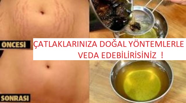 Evde yapabileceğiniz bu doğal karışımlarla çatlaklara veda edin