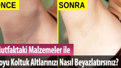 Koltuk Altı Kararması İçin Çözüm