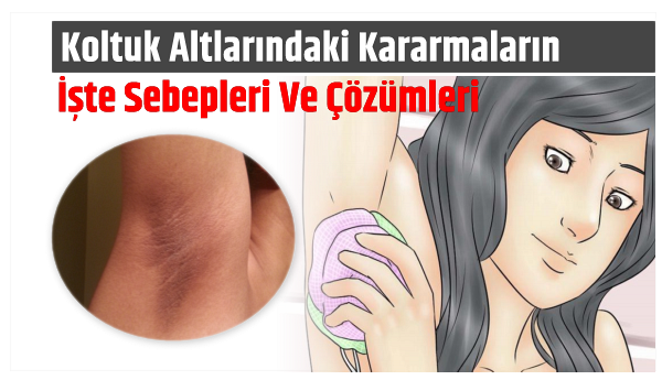 Koltuk Altlarındaki Kararmaların İşte Sebepleri Ve Çözümleri