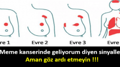 Meme Kanserinde Geliyorum Diyen Sinyaller! Aman göz ardı etmeyin
