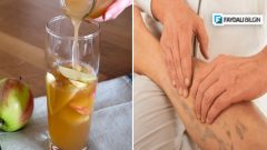 Sirke ile ev yapımı varis önleyici kür tarifi