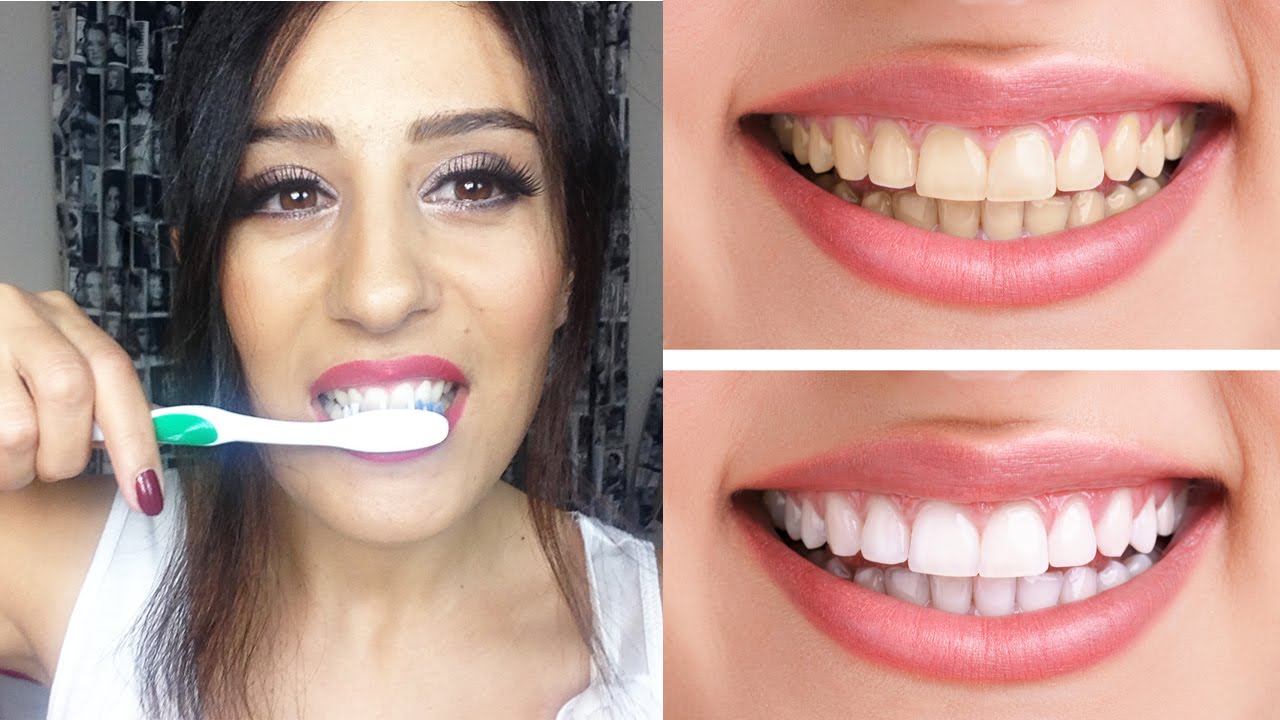 Bembeyaz Dişlere Sahip Olmak için evde doğal diş beyazlatma yöntemleri