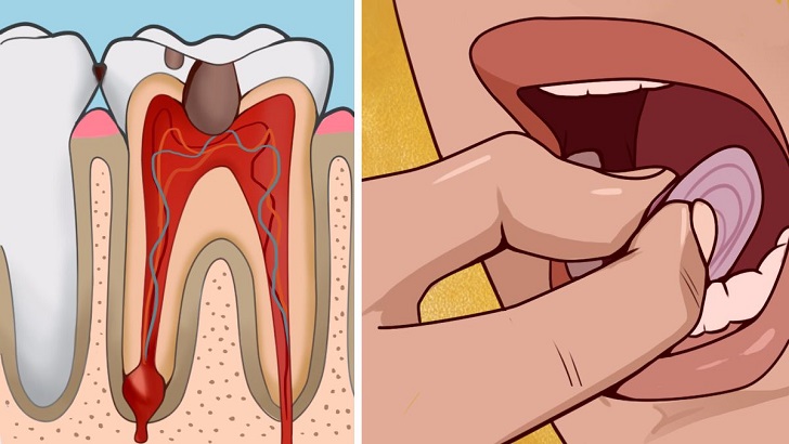 Diş ağrısını çeken bilir ağrıyı bıçak gibi kesecek yöntemler var