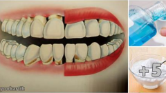 Tartar ve diş eti problemlerinden kurtulmak bu karışımla artık çok kolay