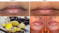 Pancar İle 2 Dakikada Dolgun Dudaklara Sahip Olun