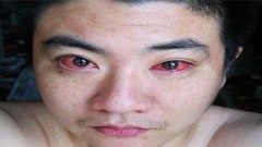 Telefon Göz Kanseri Yaptı