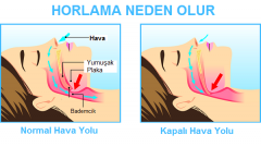 Dikkat! Horlama neden olur? Hangi hastalıklara sebep oluyor