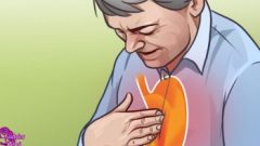 Mide Yanması Reflü Ülser ya da gastrit hastasıysanız