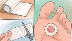 Su Toplayan Bölgeyi Tedavi Etmek İçin  Ev Reçetesi