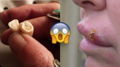 Tırnaklarını Yemekten Vazgeçemeyenler Bu Gerçeklerden Sonra