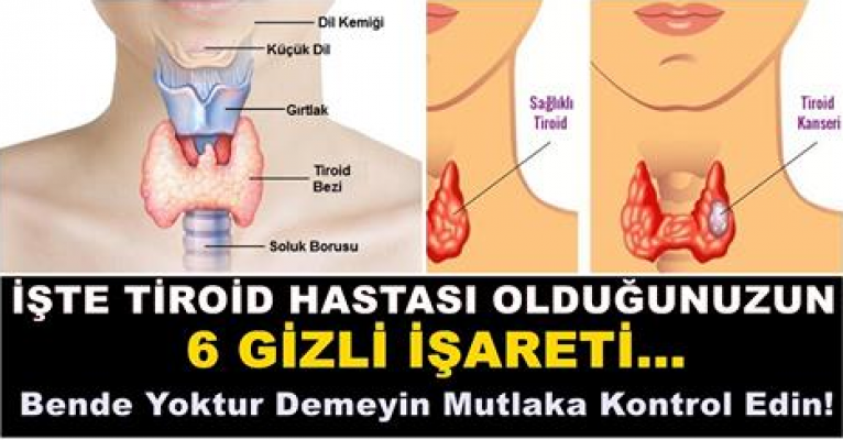 İşte Tiroid Hastası Olduğunuzun 6 Gizli İşareti