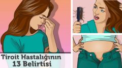 Tiroit Hastalığının Bu Belirtileri Sizde  Varsa Bir Doktora Görünmelisiniz