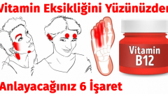 Vitamin Eksikliğinizi Yüzünüzden Anlayacağınız İşaretler