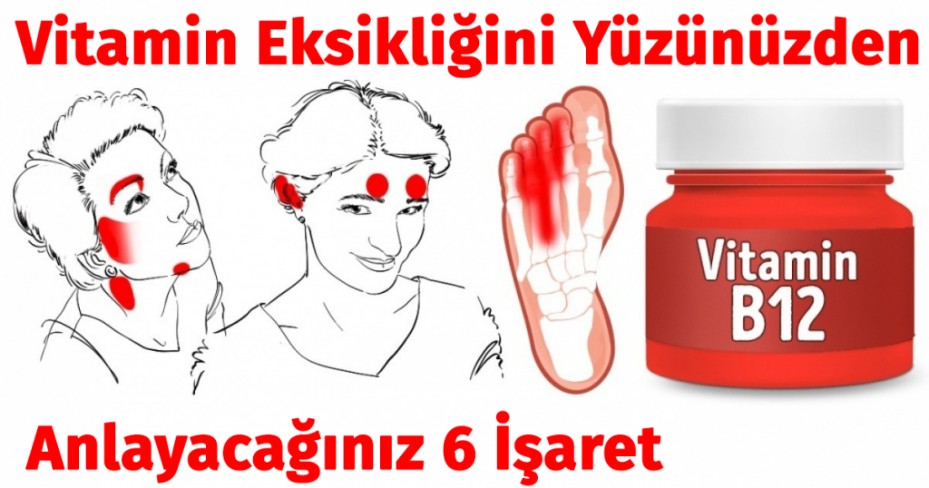 Vitamin Eksikliğinizi Yüzünüzden Anlayacağınız İşaretler