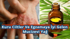 Kuru Ciltler Ve Egzamaya İyi Gelen Mucizevi Yağ